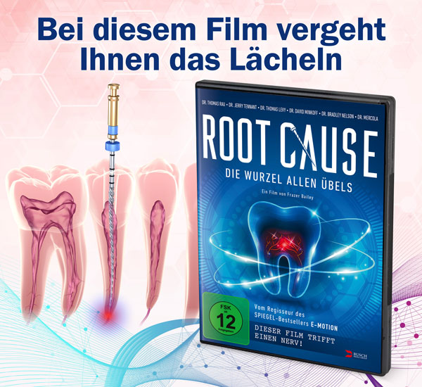 Root Cause - Die Wurzel allen �bels DVD